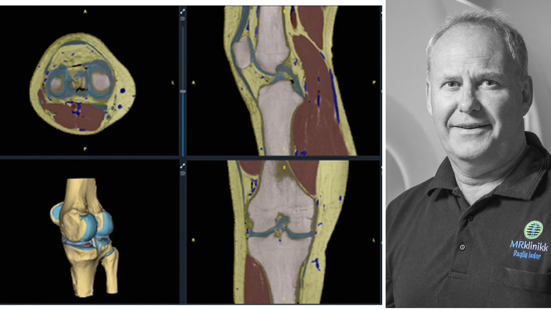 A Alesund startup nominert til gjev pris